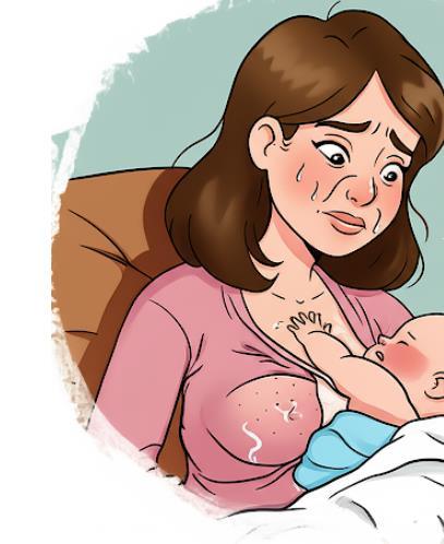 دانلود pdf مشکلات پستان در شیردهی کمیاب و عالی