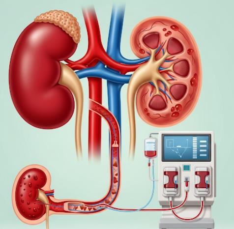 دانلود pdf نارسایی کلیه و دیالیز کمیاب و عالی